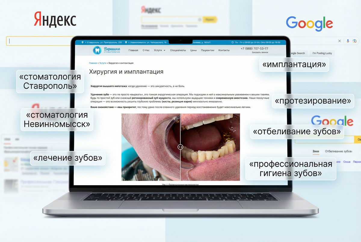 Геозависимые запросы сайта стоматологии «Вершина» в Ставрополе